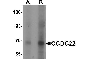 Western blot analysis of CCDC22 in 293 cell lysate with CCDC22 antibody at (A) 1 and (B) 2 µg/mL. (CCDC22 antibody  (N-Term))
