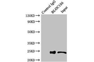 Immunoprecipitating BLOC1S6 in HEK293 whole cell lysate Lane 1: Rabbit control IgG instead of (1 μg) instead of ABIN7145610 in HEK293 whole cell lysate. (Pallidin antibody  (AA 1-170))