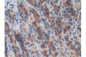 Detection of LRRC32 in Rat Stomach Tissue using Polyclonal Antibody to Leucine Rich Repeat Containing Protein 32 (LRRC32) (LRRC32 antibody  (AA 162-405))