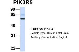 Host: Rabbit  Target Name: PIK3R5  Sample Tissue: Human Fetal Brain  Antibody Dilution: 1. (PIK3R5 antibody  (N-Term))