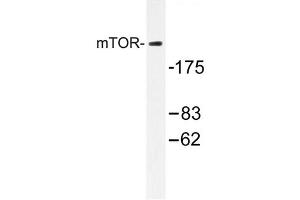 Image no. 1 for anti-Mechanistic Target of Rapamycin (serine/threonine Kinase) (mTOR) antibody (ABIN272127) (MTOR antibody)