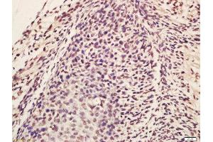 Formalin-fixed and paraffin embedded mouse embryo labeled with Rabbit Anti-Lin28 Polyclonal Antibody, Unconjugated (ABIN1386838) at 1:200 followed by conjugation to the secondary antibody and DAB staining (Lin28A/ B (AA 75-180) antibody)