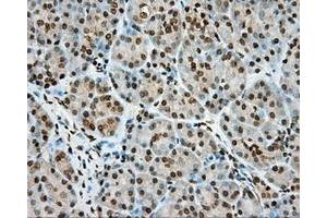 Immunohistochemical staining of paraffin-embedded Human colon tissue using anti-MTRF1L mouse monoclonal antibody.