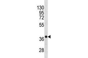 Western Blotting (WB) image for anti-Chemokine (C-X-C Motif) Receptor 4 (CXCR4) (AA 50-79) antibody (ABIN3030512)