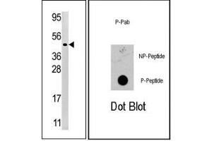 Image no. 1 for anti-Mitogen-Activated Protein Kinase Kinase 1 (MAP2K1) (pSer217), (pSer221) antibody (ABIN358157)