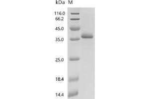 Filamin A, alpha (FLNA) (AA 500-750) protein (G4S-His Tag)