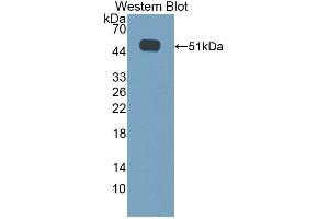 Western blot analysis of the recombinant protein. (CACNA1H antibody  (AA 2160-2359))