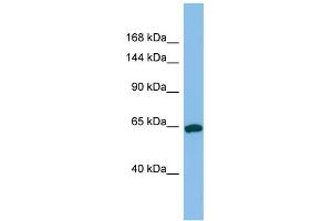 Host:  Rabbit  Target Name:  TPO  Sample Type:  Jurkat Whole Cell lysates  Antibody Dilution:  1. (Thyroperoxidase antibody  (N-Term))