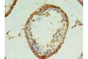 Immunohistochemistry of paraffin-embedded human testis tissue using ABIN7147533 at dilution of 1:100 (CHMP6 antibody  (AA 2-201))