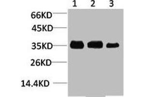 Western blot analysis of 1) Human Brain Tissue, 2) Mouse Brain Tissue, 3) Rat Brain Tissue using L-type Ca++ CP γ4 Polyclonal Antibody. (CACNG4 antibody)