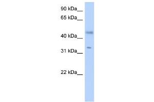 WB Suggested Anti-RDHE2 Antibody Titration: 0. (SDR16C5 antibody  (Middle Region))
