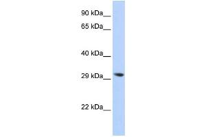 WB Suggested Anti-LYPLA2 Antibody Titration: 0.