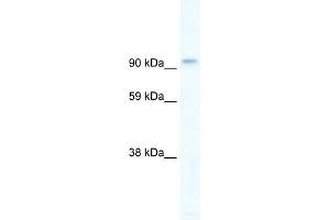 PIK3CB antibody used at 5 ug/ml to detect target protein. (PIK3CB antibody  (C-Term))