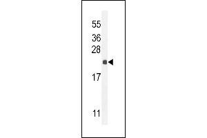 hCG_2024410 Antibody (C-term) (ABIN654993 and ABIN2850479) western blot analysis in mouse liver tissue lysates (35 μg/lane). (hCG_2024410 (AA 187-215), (C-Term) antibody)
