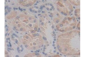Detection of MAP2K6 in Human Kidney Tissue using Polyclonal Antibody to Mitogen Activated Protein Kinase Kinase 6 (MAP2K6) (MAP2K6 antibody  (AA 46-306))