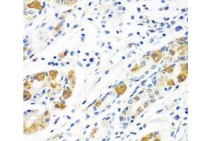 Immunohistochemistry of paraffin-embedded Human stomach using BLVRB Polyclonal Antibody at dilution of 1:100 (40x lens). (BLVRB antibody)