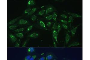 Immunofluorescence analysis of U-2 OS cells using COX6A1 Polyclonal Antibody at dilution of 1:100 (40x lens). (COX6A1 antibody)