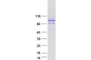 SPG20 Protein (Transcript Variant 4) (Myc-DYKDDDDK Tag)