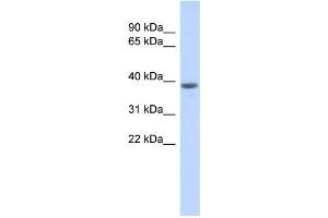 WB Suggested Anti-WDR21B Antibody Titration: 0. (DCAF4L1 antibody  (Middle Region))