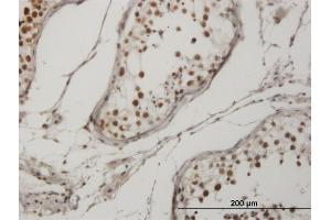 Immunoperoxidase of monoclonal antibody to CRKRS on formalin-fixed paraffin-embedded human testis. (CDK12 antibody  (AA 1281-1380))