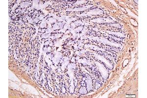 Formalin-fixed and paraffin embedded human kidney labeled with Anti-GSDMA Polyclonal Antibody, Unconjugated  at 1:300 followed by conjugation to the secondary antibody and DAB staining. (Gasdermin A antibody  (AA 21-120))