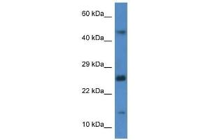 Western Blot showing Gabarapl2 antibody used at a concentration of 1. (GABARAPL2 antibody  (C-Term))