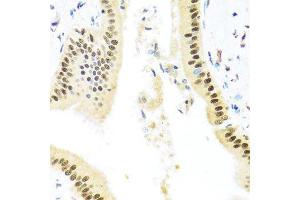 Immunohistochemistry of paraffin-embedded human liver injury using ZBTB17 antibody (ABIN5974597) at dilution of 1/100 (40x lens). (ZBTB17 antibody)