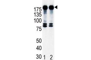 Western blot analysis of ErbB2 in T47D cell lysate, either noninduced (Lane 1) or induced with HRG (2). (ErbB2/Her2 antibody  (AA 21-52))