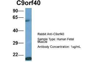Host: Rabbit  Target Name: C9orf40  Sample Tissue: Human Fetal Muscle  Antibody Dilution: 1. (C9orf40 antibody  (Middle Region))