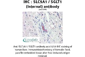 Image no. 2 for anti-Solute Carrier Family 5 (Sodium/glucose Cotransporter), Member 1 (SLC5A1) (Internal Region) antibody (ABIN1739389) (SLC5A1 antibody  (Internal Region))