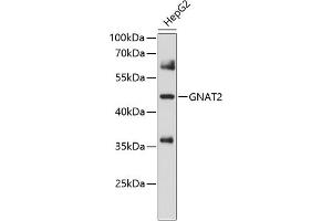 Western blot analysis of extracts of HepG2 cells, using GN antibody (ABIN6132936, ABIN6141215, ABIN6141216 and ABIN6214578) at 1:1000 dilution. (GNAT2 antibody  (AA 1-220))