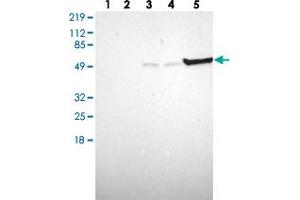 Western blot analysis of Lane 1: Human cell line RT-4, Lane 2: Human cell line U-251MG sp, Lane 3: Human cell line A-431, Lane 4: Human liver tissue, Lane 5: Human tonsil tissue with TYMP polyclonal antibody . (Thymidine Phosphorylase antibody)