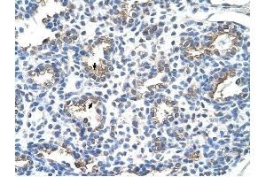 CEACAM6 antibody was used for immunohistochemistry at a concentration of 4-8 ug/ml to stain Alveolar cells (arrows) in Human Lung. (CEACAM6 antibody)