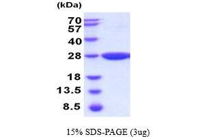 SDS-PAGE (SDS) image for Glutathione S-Transferase, pi 2 (GSTP2) (AA 1-210) protein (His tag) (ABIN6387701) (GSTP2 Protein (AA 1-210) (His tag))