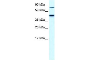 WB Suggested Anti-EPB42 Antibody Titration:  0. (EPB42 antibody  (Middle Region))