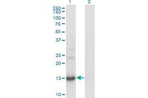 Western Blot analysis of BTG2 expression in transfected 293T cell line by BTG2 monoclonal antibody (M01), clone 1A5. (BTG2 antibody  (AA 59-158))