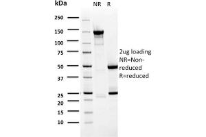 SDS-PAGE Analysis Purified BARX1 Mouse Monoclonal Antibody (BARX1/2759). (BARX1 antibody  (AA 155-254))