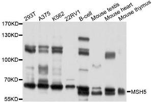 Western blot analysis of extracts of various cells, using MSH5 antibody. (MSH5 antibody)