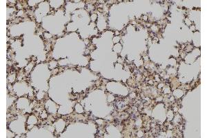 ABIN6279149 at 1/100 staining Mouse lung tissue by IHC-P. (ATXN7L3 antibody  (Internal Region))