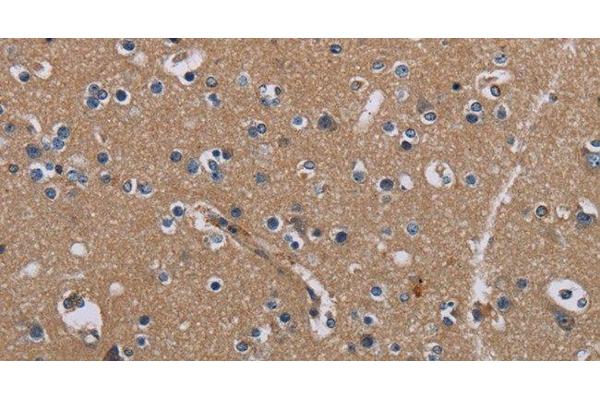 PIDD antibody