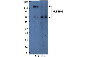 Western blot analysis of SREBP-2.