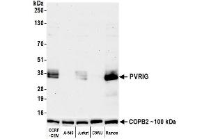 anti-Poliovirus Receptor-Related Immunoglobulin Domain Containing (PVRIG) (AA 200-250) antibody