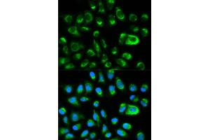 Immunofluorescence analysis of HeLa cells using GAS2 antibody (ABIN5970514). (GAS2 antibody)