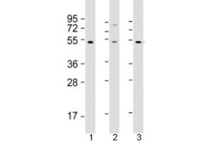 Western blot testing of human 1) HT-1080, 2) SH-SY5Y and 3) Y79 cell lysate with ZNF513 antibody at 1:2000.