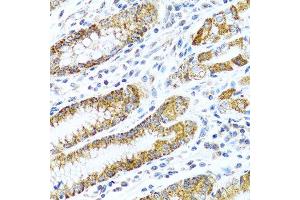 Immunohistochemistry of paraffin-embedded human stomach using LRPPRC antibody.