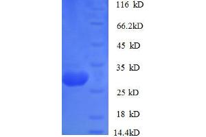 Cathepsin K (CTSK) (AA 115-329) protein (His tag) expressed in E. (Cathepsin K Protein (CTSK) (AA 115-329) (His tag))