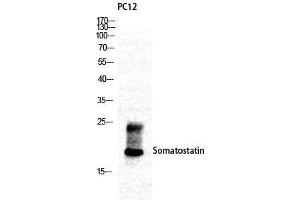 Western Blot (WB) analysis of specific cells using Somatostatin Polyclonal Antibody. (Somatostatin antibody  (N-Term))