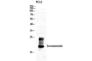 Western Blot (WB) analysis of specific cells using Somatostatin Polyclonal Antibody. (Somatostatin antibody  (N-Term))