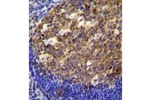 Formalin fixed, paraffin embedded human tonsil tissue reacted with PTK9L (arrow) using PTK9L Antibody (N-term) followed by peroxidase conjugation of the secondary antibody and DAB staining. (TWF2 antibody  (N-Term))