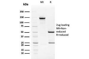 SDS-PAGE Analysis Purified TIM3 Mouse Monoclonal Antibody (TIM3/2399). (TIM3 antibody  (AA 22-202))